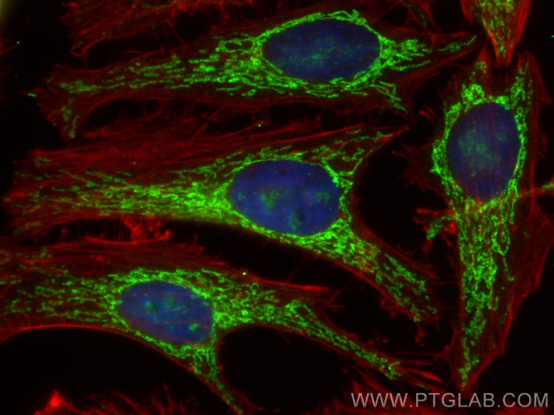 IF Staining of HeLa using 10434-1-AP