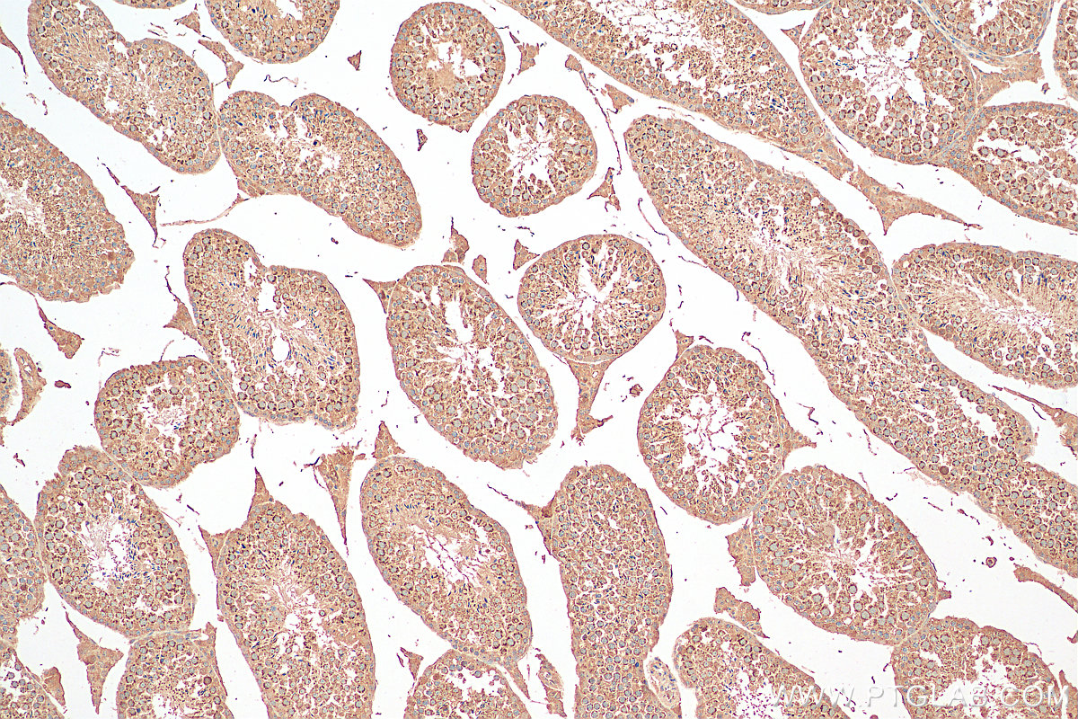 IHC staining of mouse testis using 10434-1-AP