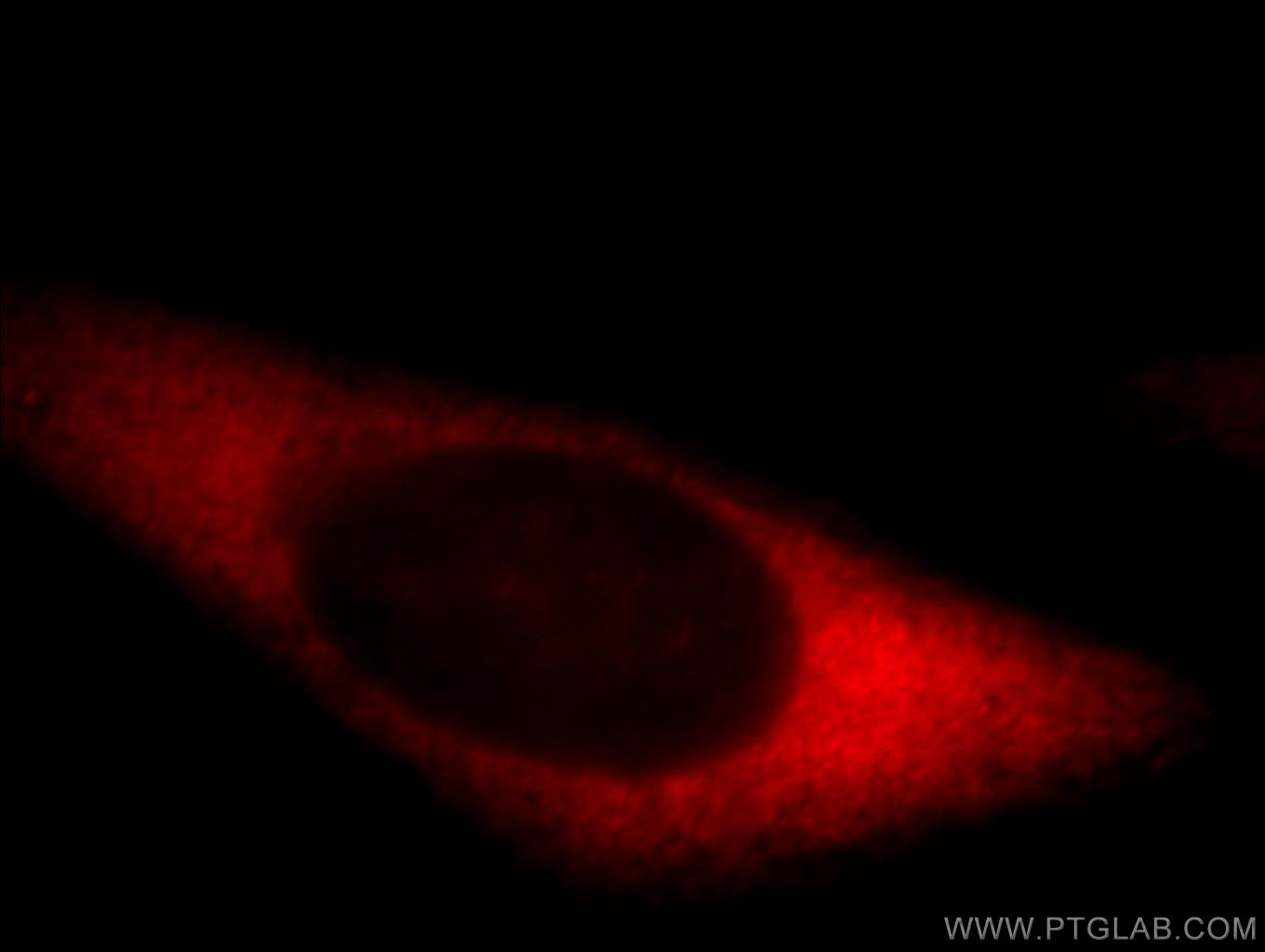 IF Staining of HepG2 using 20624-1-AP