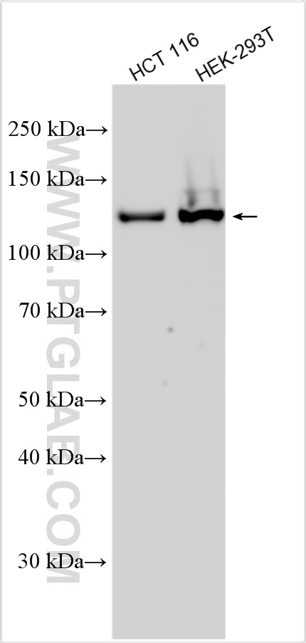 WB analysis using 31304-1-AP