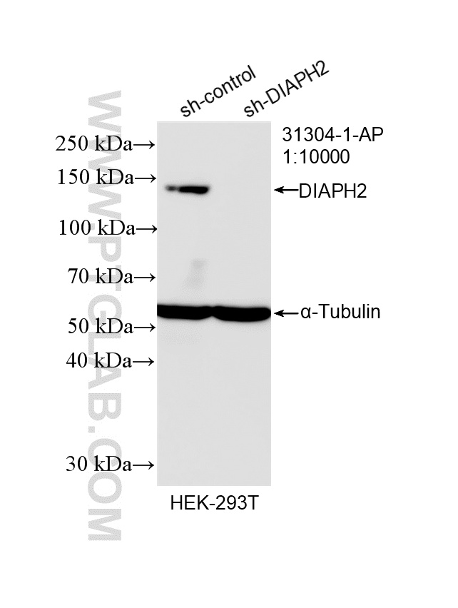 WB analysis of HEK-293T using 31304-1-AP