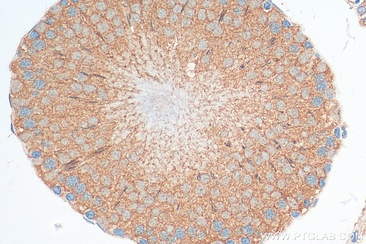 IHC staining of rat testis using 14342-1-AP