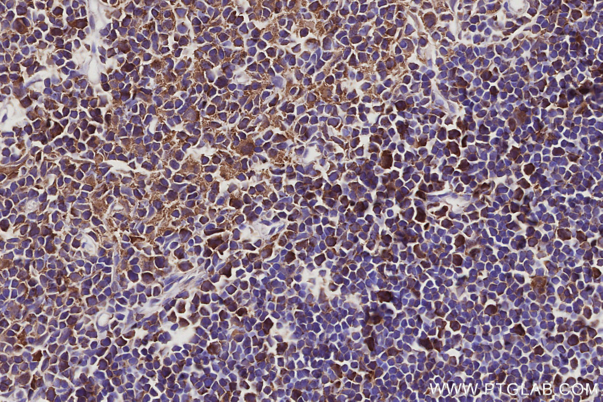 IHC staining of rat thymus using 14342-1-AP