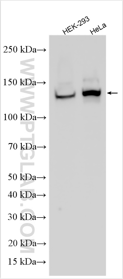 WB analysis using 14342-1-AP