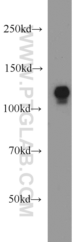 WB analysis of HeLa using 14342-1-AP