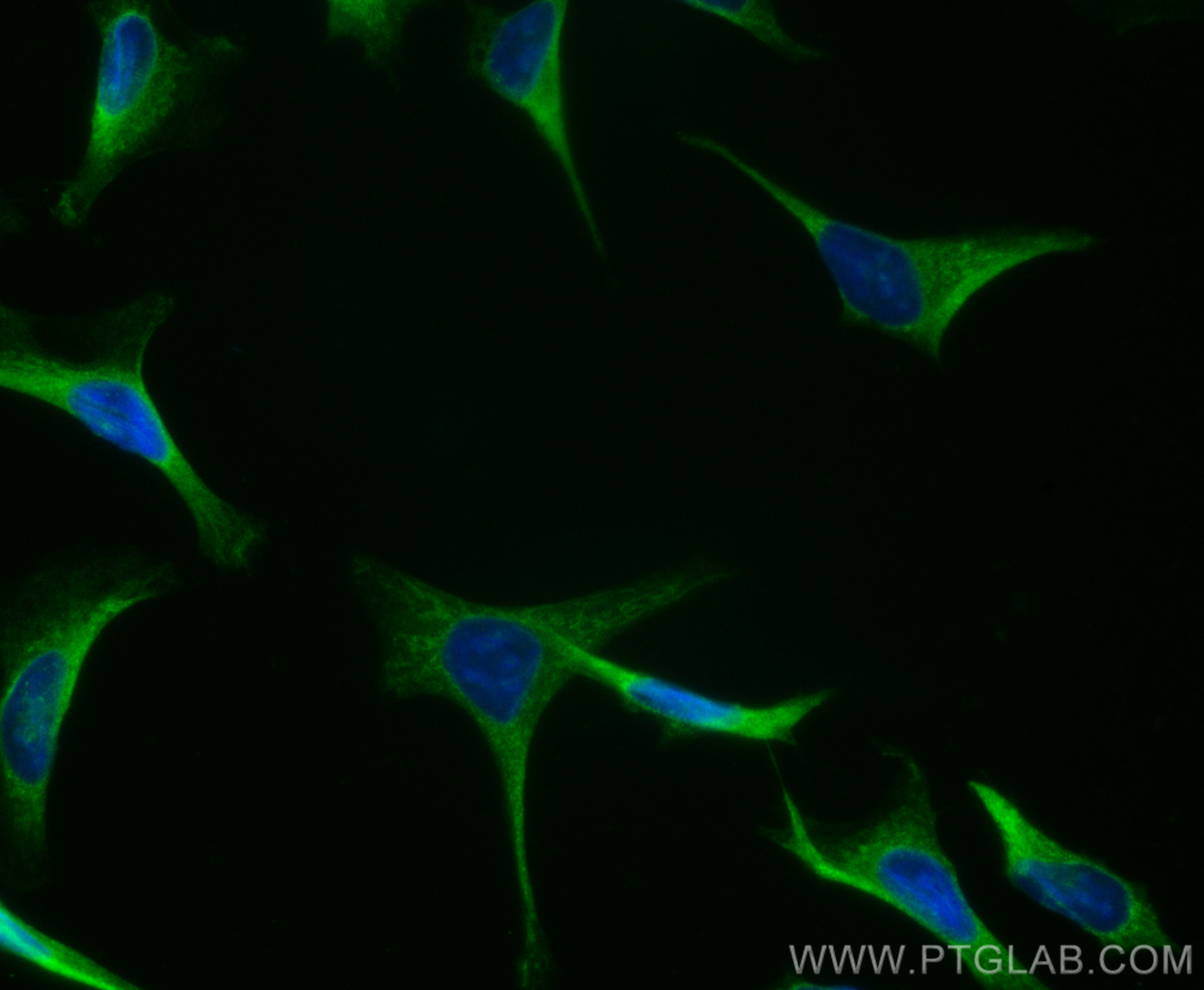 IF Staining of HeLa using CL488-14342