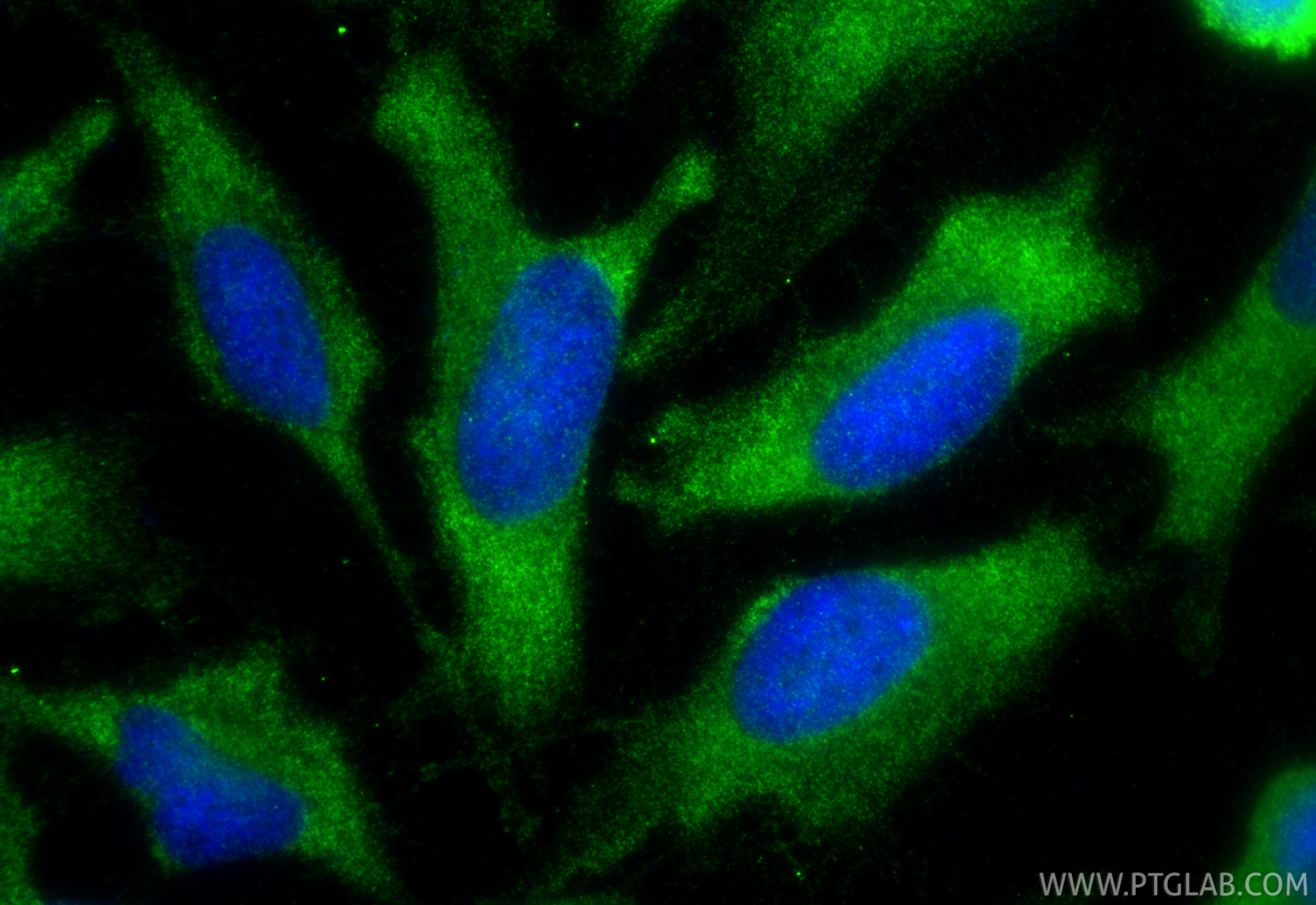 IF Staining of HeLa using RMX00041