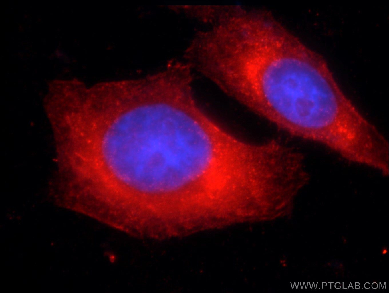 IF Staining of HepG2 using 20567-1-AP