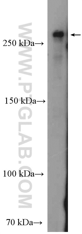 WB analysis of HeLa using 20567-1-AP