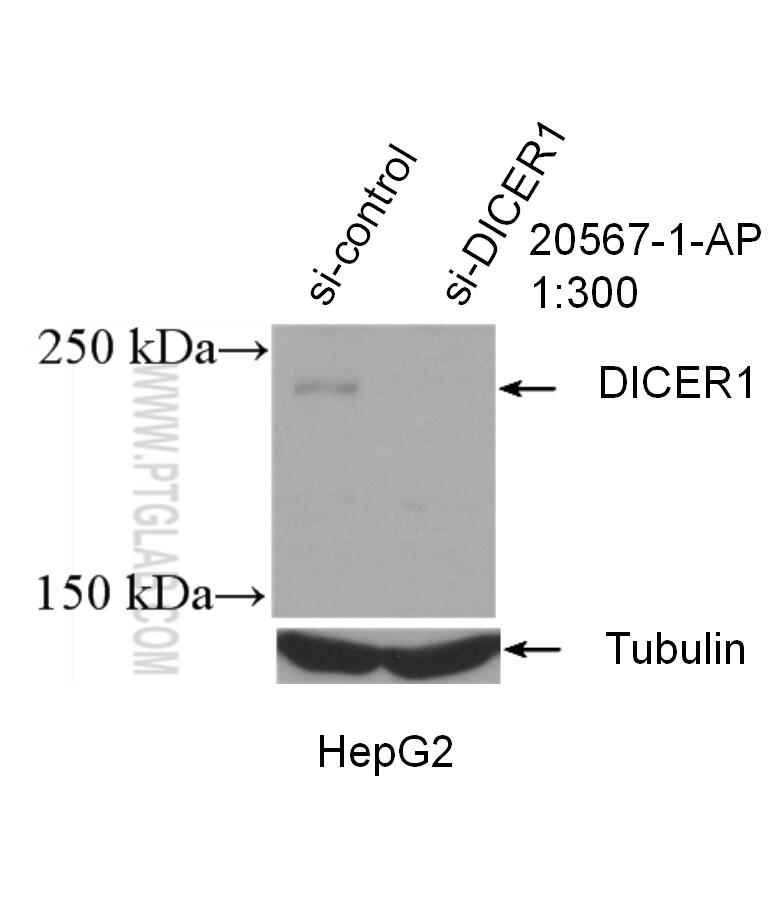 WB analysis of HepG2 using 20567-1-AP