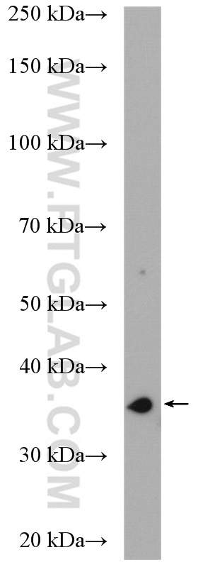 WB analysis of HeLa using 15563-1-AP