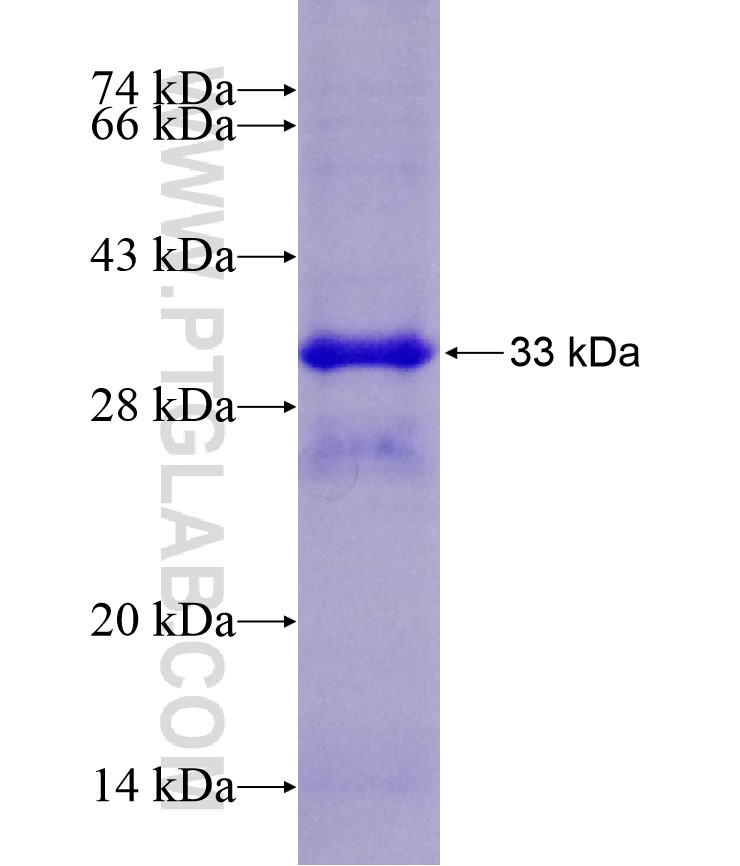 DIMT1L fusion protein Ag7736 SDS-PAGE