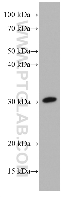 WB analysis of T-47D using 66813-1-Ig