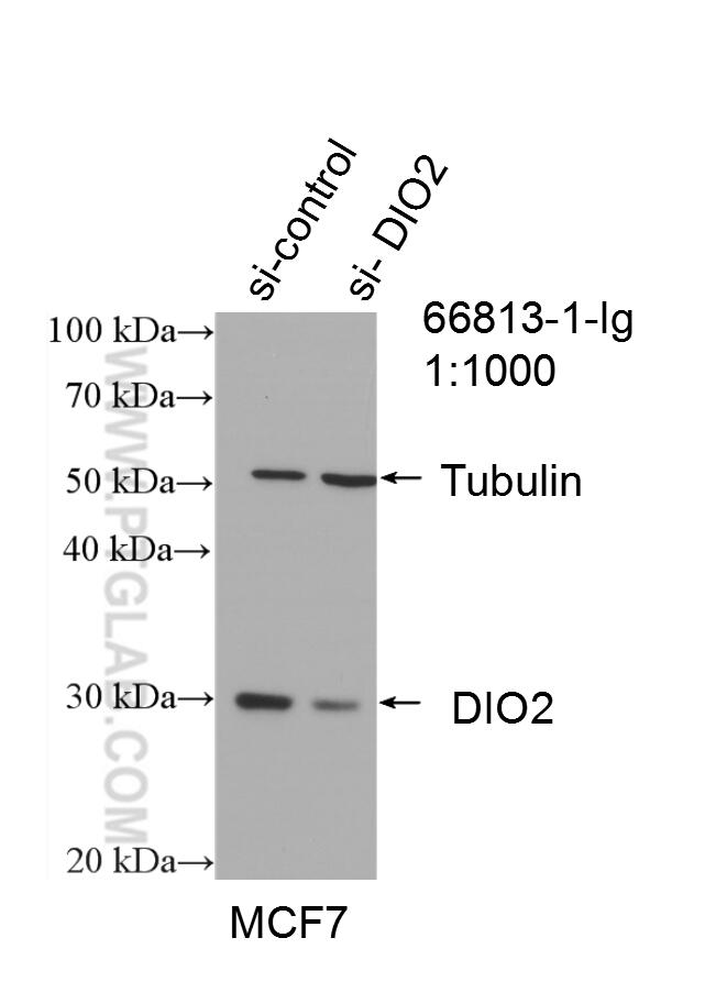 WB analysis of MCF-7 using 66813-1-Ig