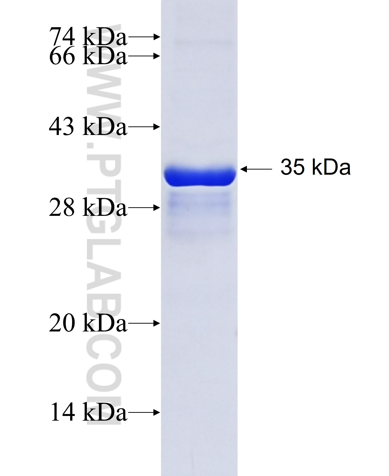 DIO2 fusion protein Ag24057 SDS-PAGE