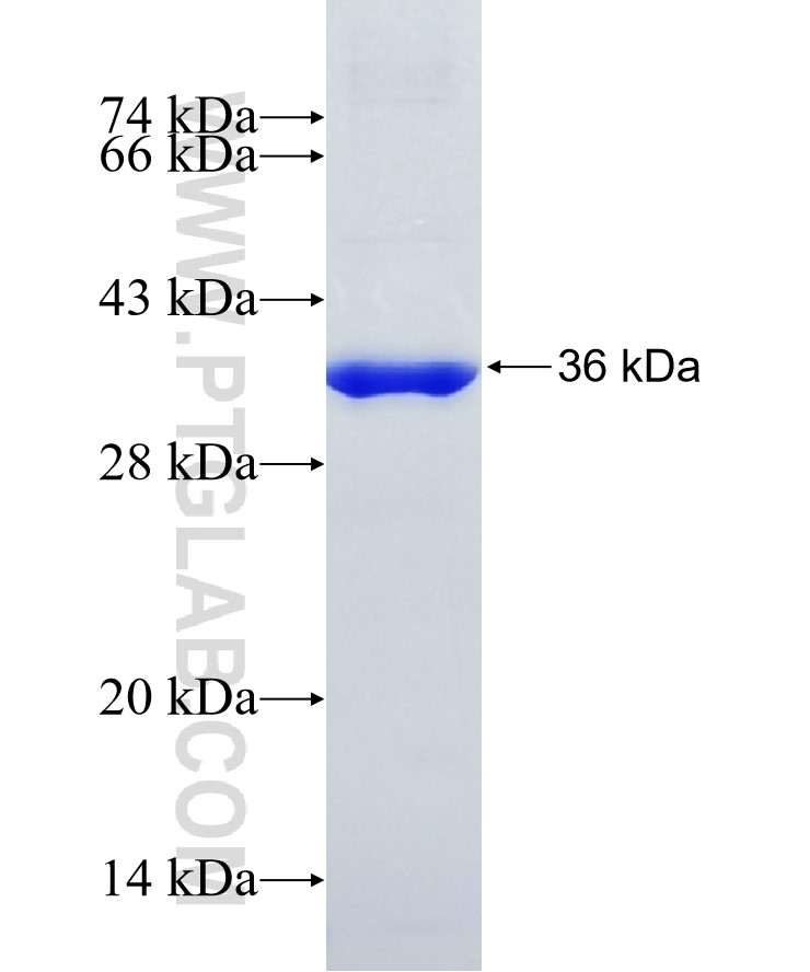 DIO3 fusion protein Ag34284 SDS-PAGE