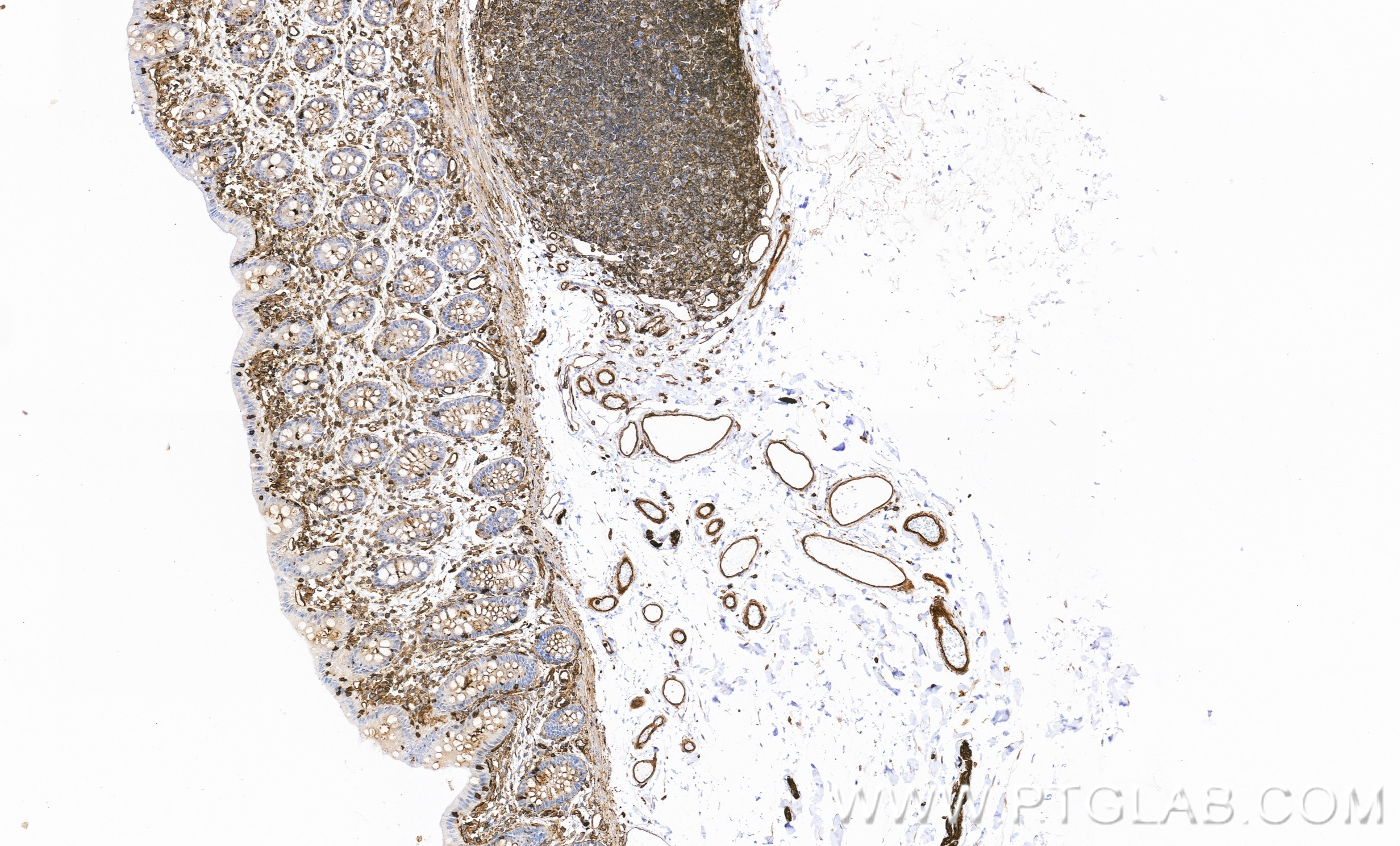 IHC staining of human colon using 86460-1-RR
