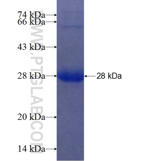DIRAS2 fusion protein Ag7814 SDS-PAGE DIRAS2 fusion protein Ag7814 SDS-PAGE