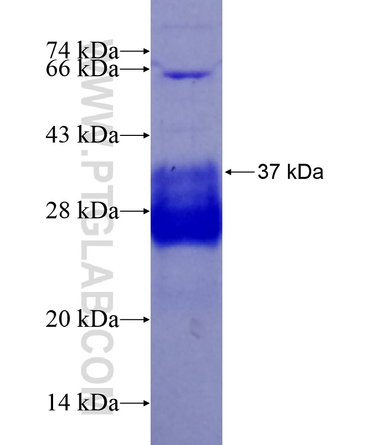 DIRC1 fusion protein Ag18534 SDS-PAGE DIRC1 fusion protein Ag18534 SDS-PAGE