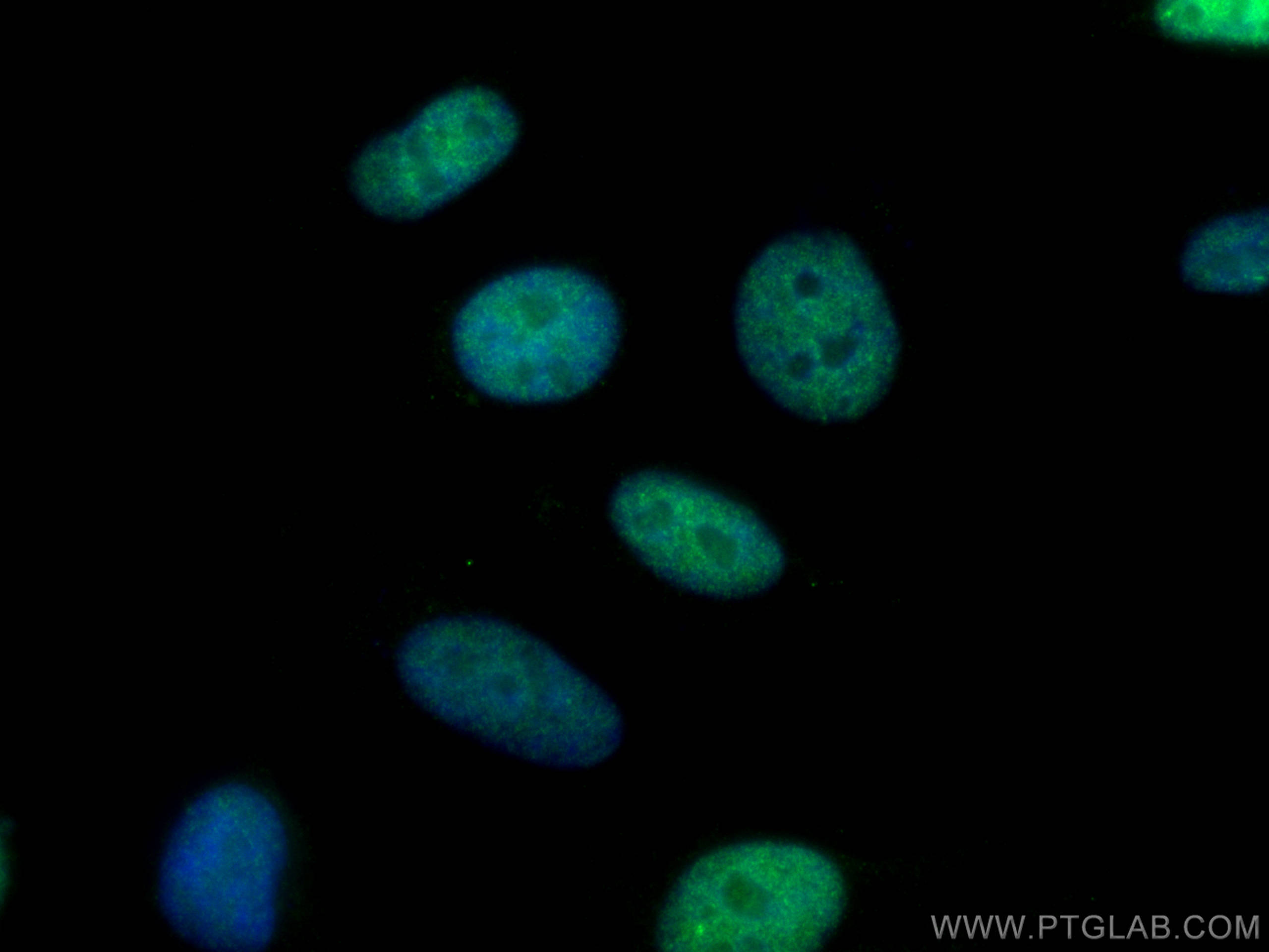 IF Staining of HeLa using 14689-1-AP