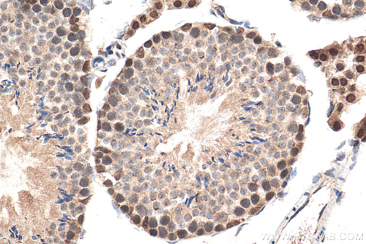 IHC staining of mouse testis using 29664-1-AP