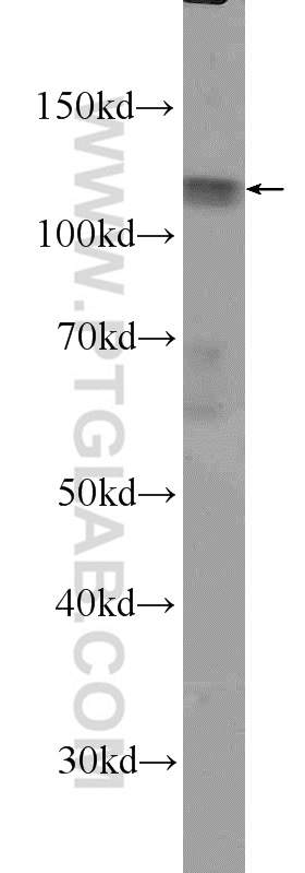 WB analysis of K-562 using 25746-1-AP