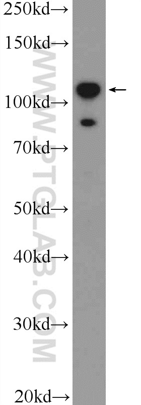 WB analysis of HepG2 using 25792-1-AP