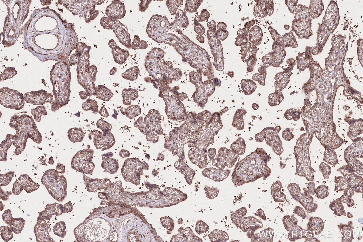 IHC staining of human placenta using 67623-1-Ig IHC staining of human placenta using 67623-1-Ig