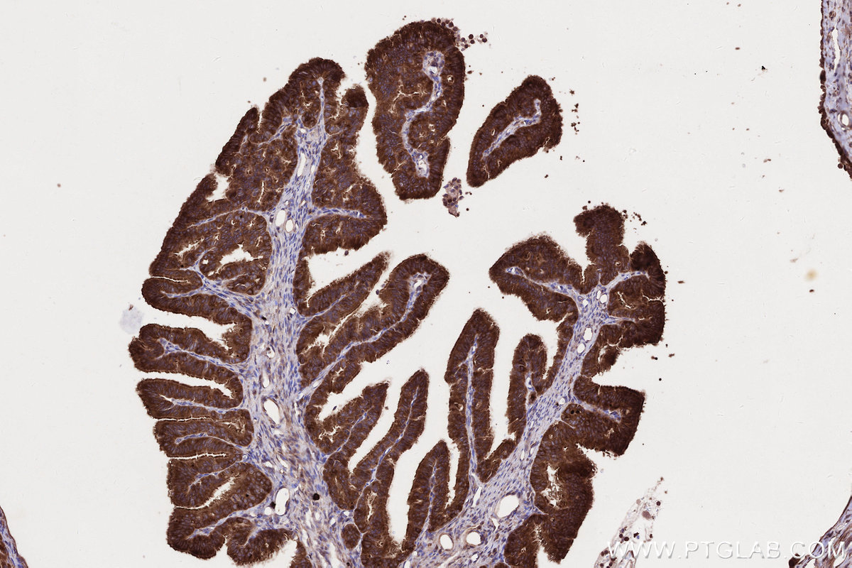 IHC staining of rat ovary using 67623-1-Ig IHC staining of rat ovary using 67623-1-Ig