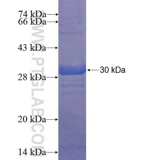DIS3L2 fusion protein Ag22995 SDS-PAGE DIS3L2 fusion protein Ag22995 SDS-PAGE