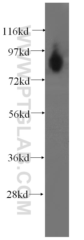 WB analysis of human kidney using 60109-1-Ig