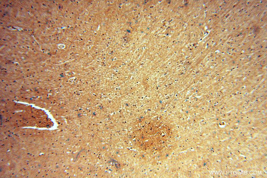 IHC staining of human brain using 15500-1-AP