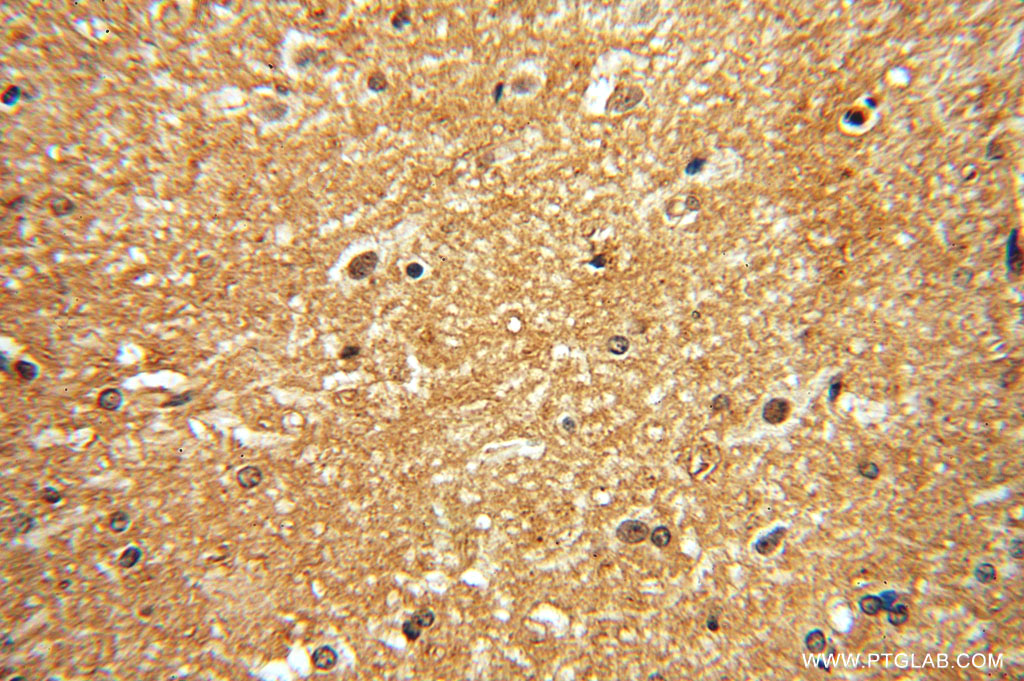 IHC staining of human brain using 15500-1-AP