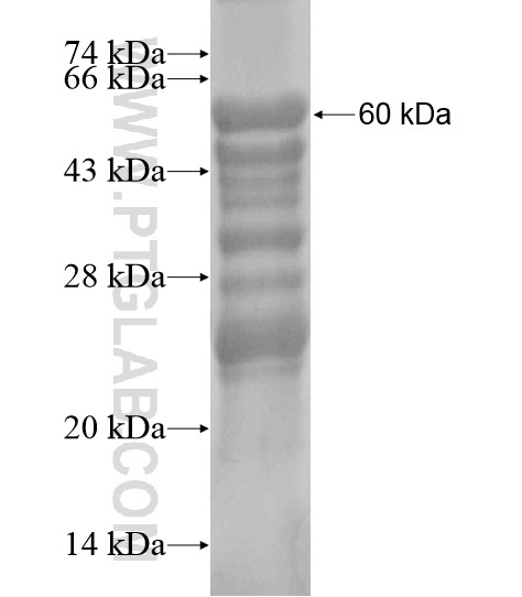 DISP2 fusion protein Ag20127 SDS-PAGE DISP2 fusion protein Ag20127 SDS-PAGE