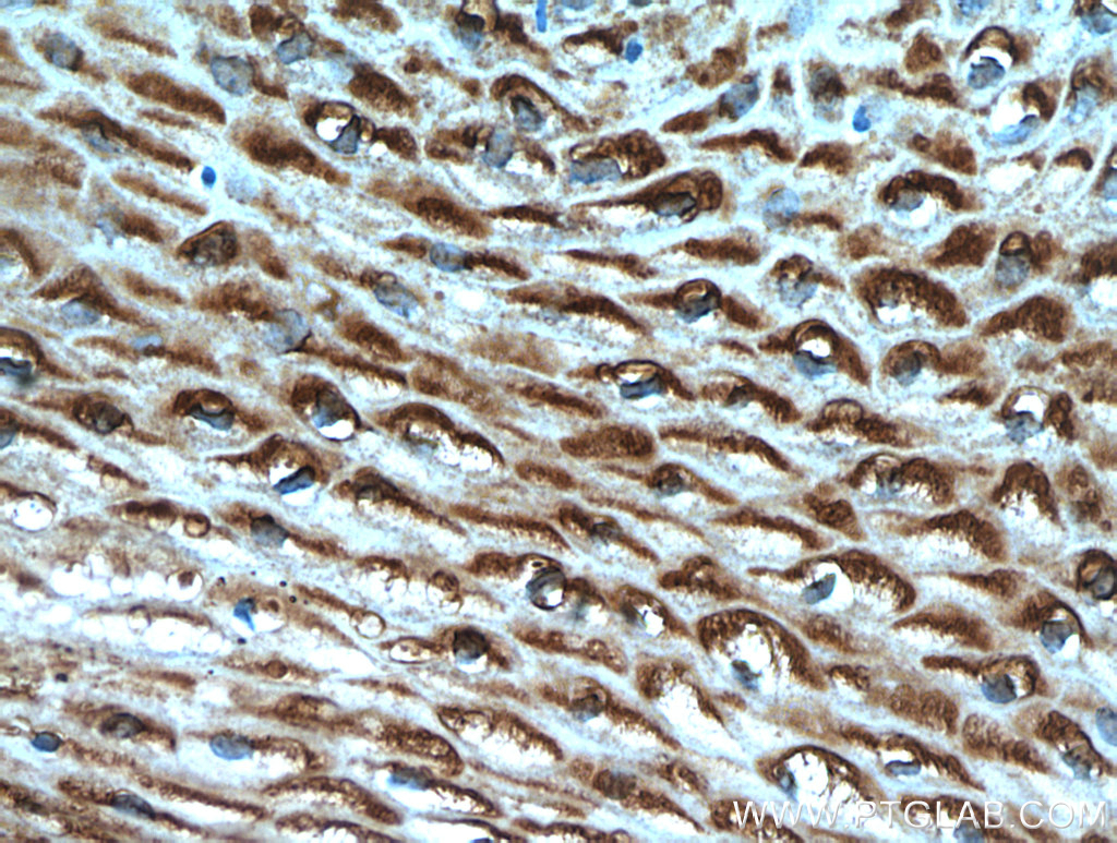 IHC staining of human cervix using 21051-1-AP
