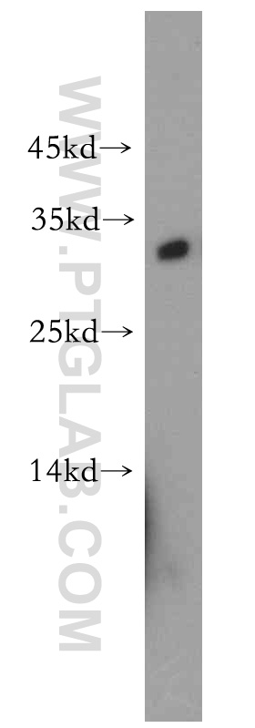 WB analysis of mouse skeletal muscle using 21051-1-AP