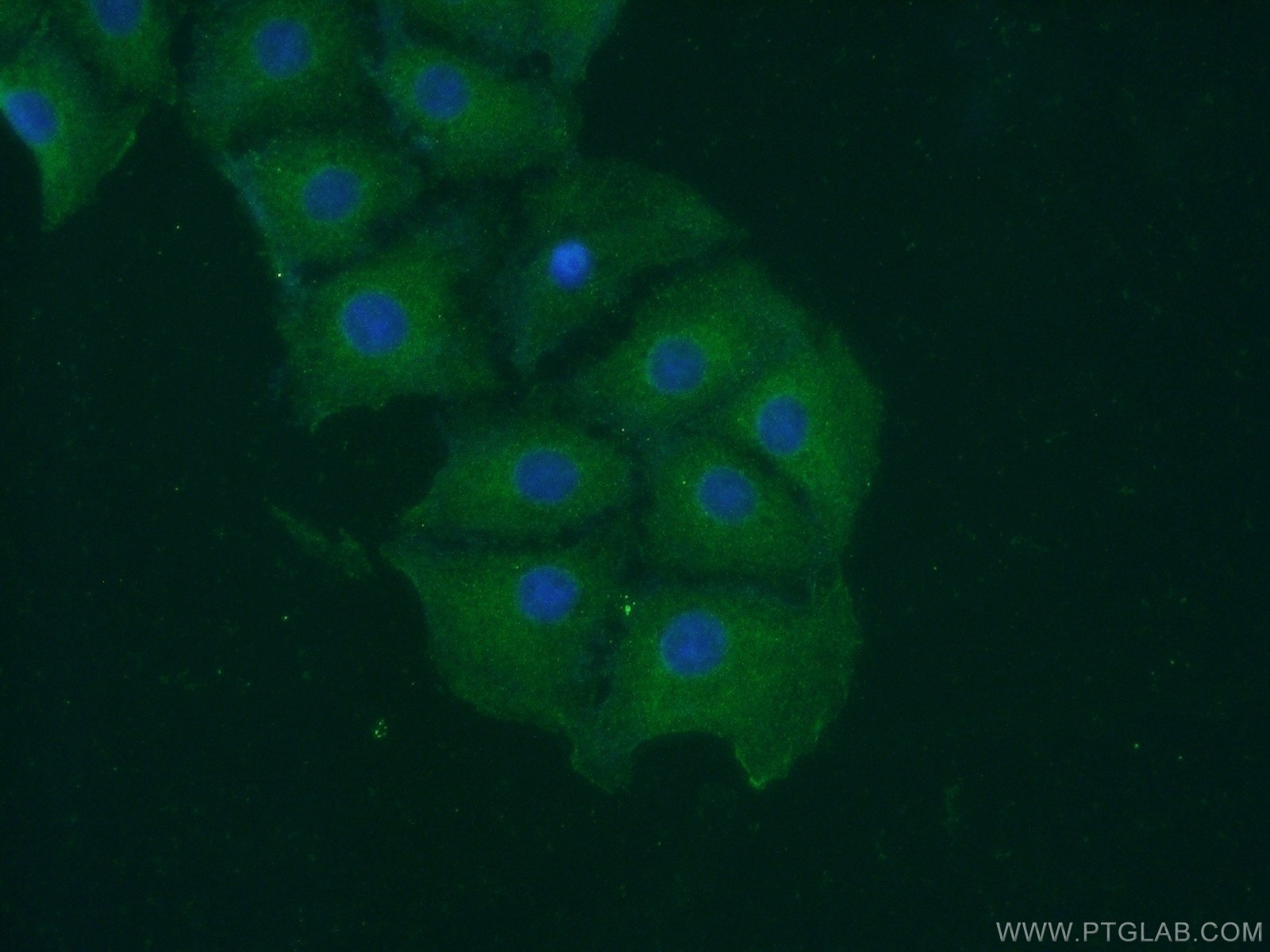 IF Staining of SH-SY5Y using 10365-1-AP