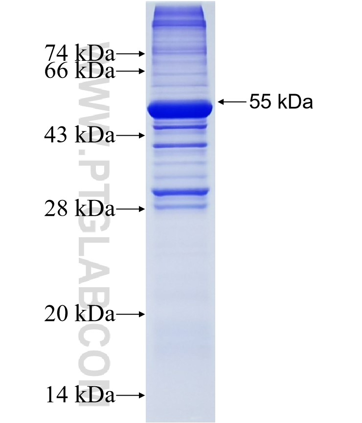 DKKL1 fusion protein Ag38371 SDS-PAGE