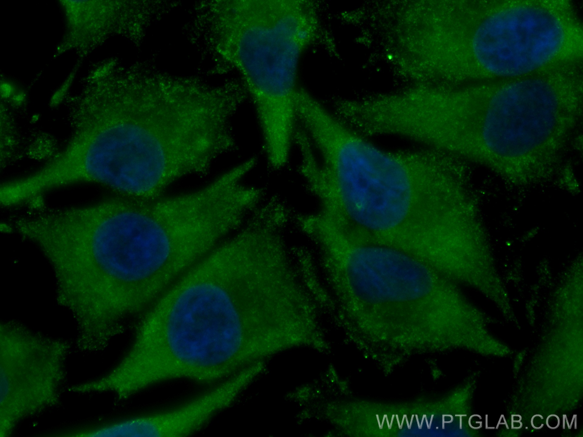 IF Staining of A375 using CL488-66894