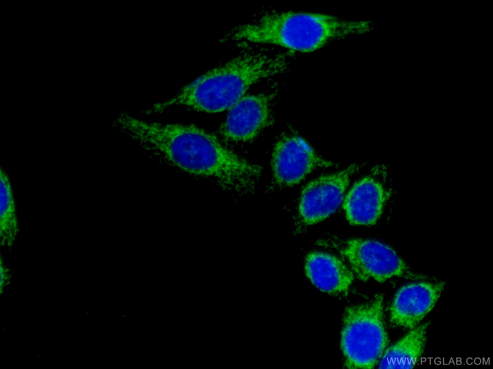 IF Staining of HepG2 using 16431-1-AP