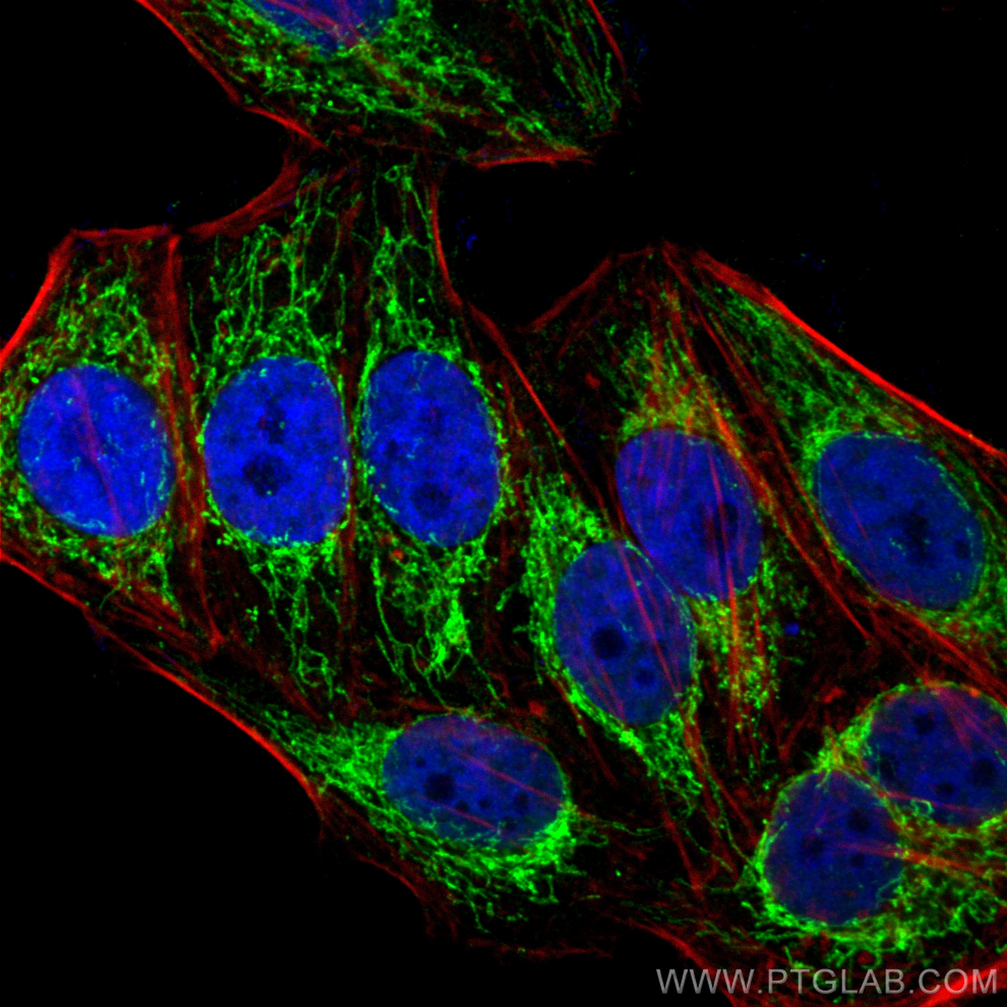 IF Staining of HepG2 using 16431-1-AP