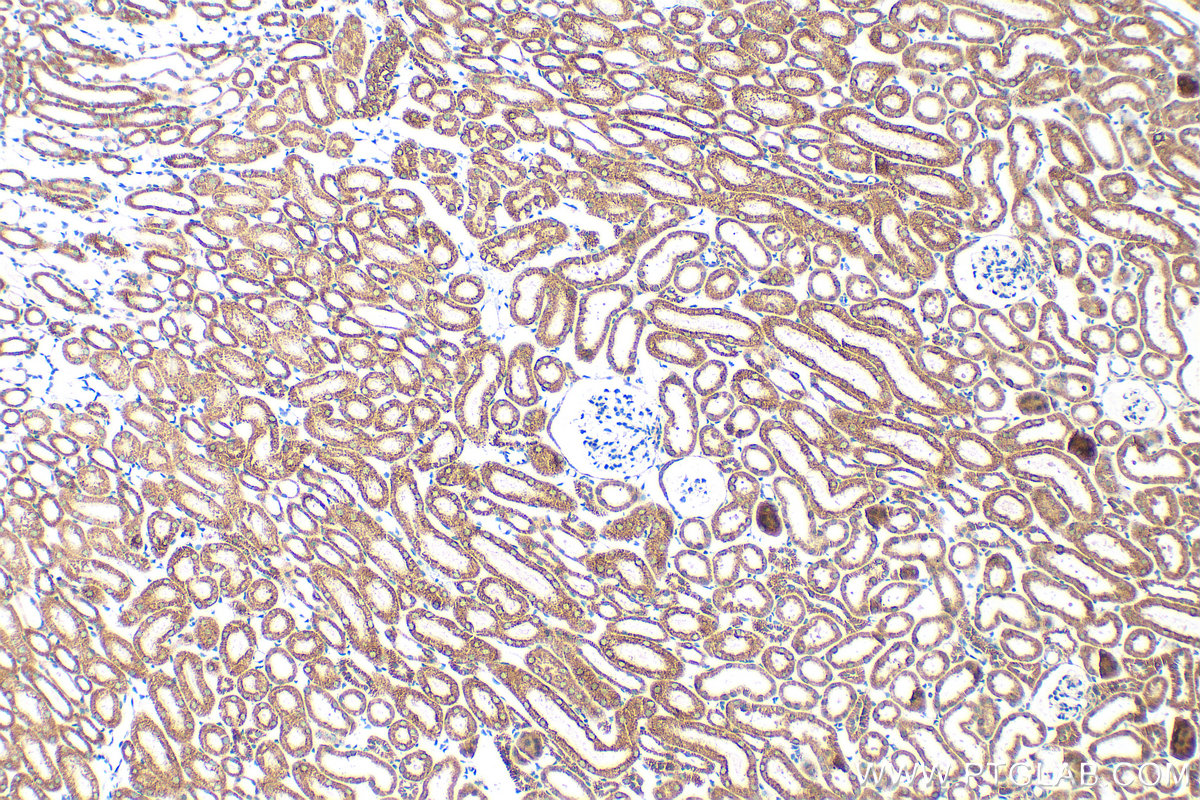 IHC staining of mouse kidney using 16431-1-AP
