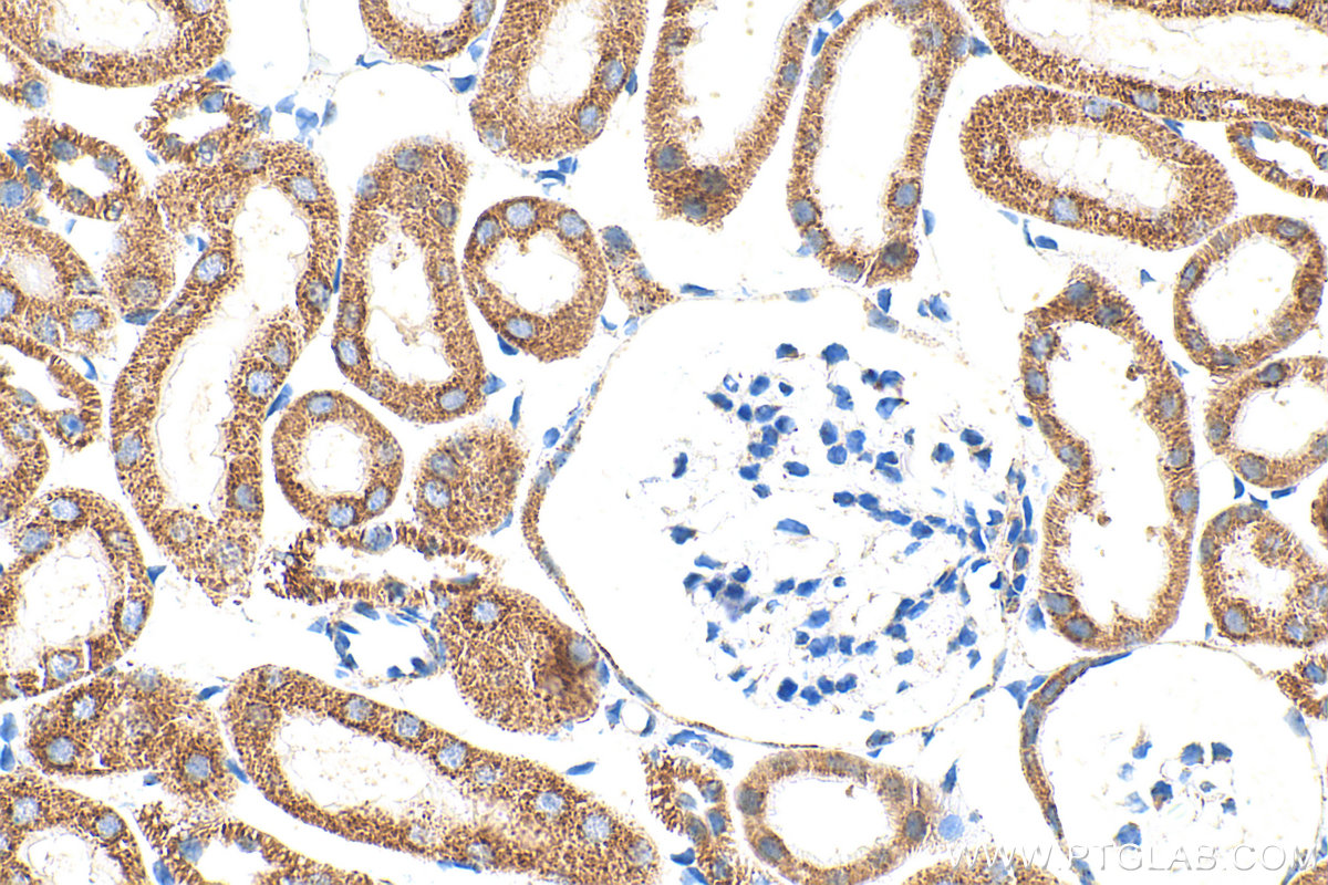 IHC staining of mouse kidney using 16431-1-AP