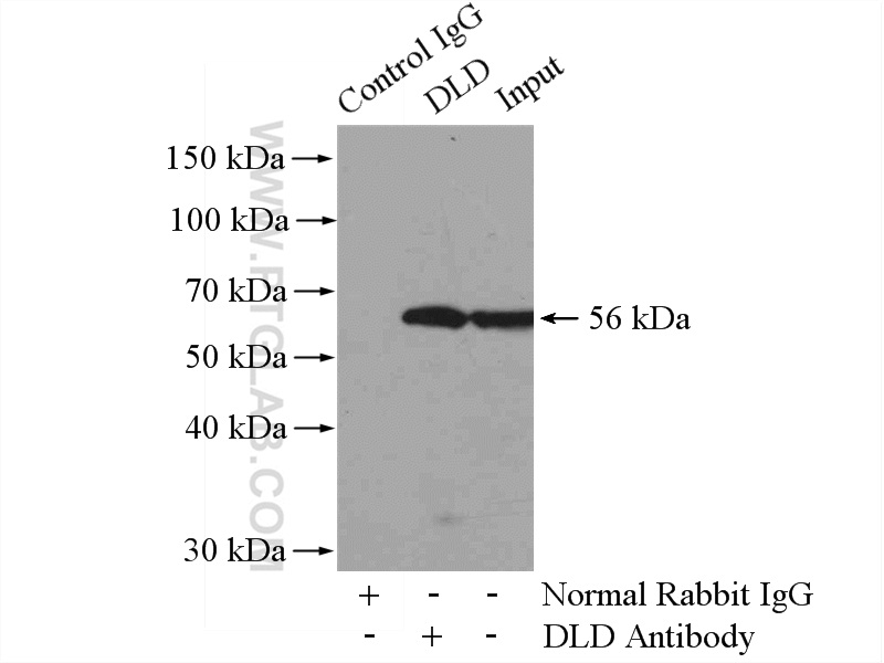 IP experiment of mouse liver using 16431-1-AP