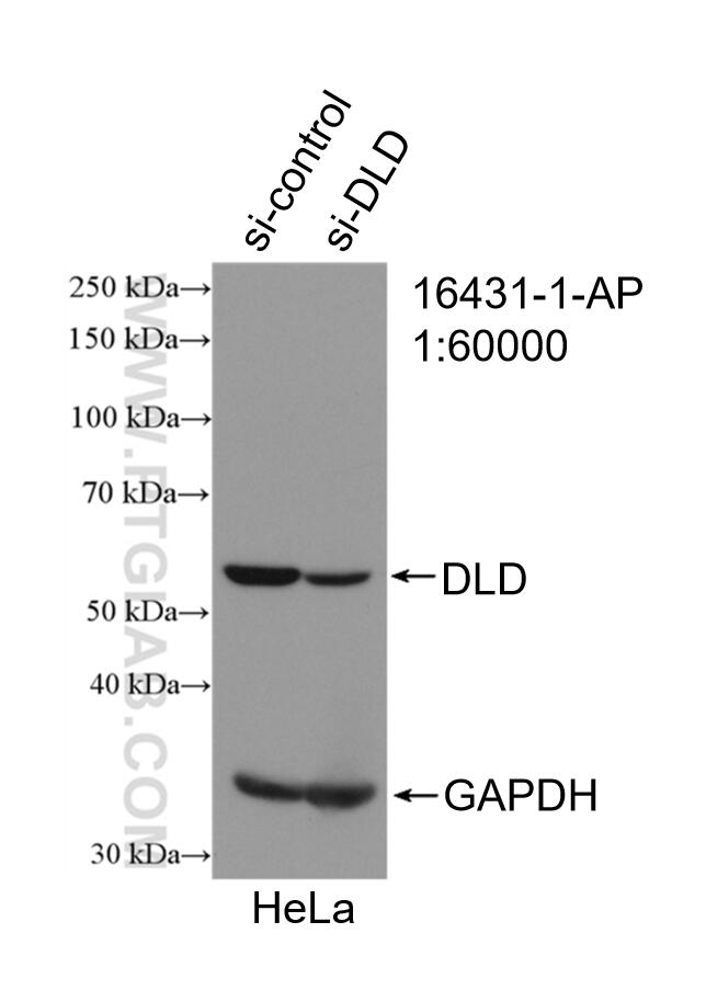 WB analysis of HeLa using 16431-1-AP