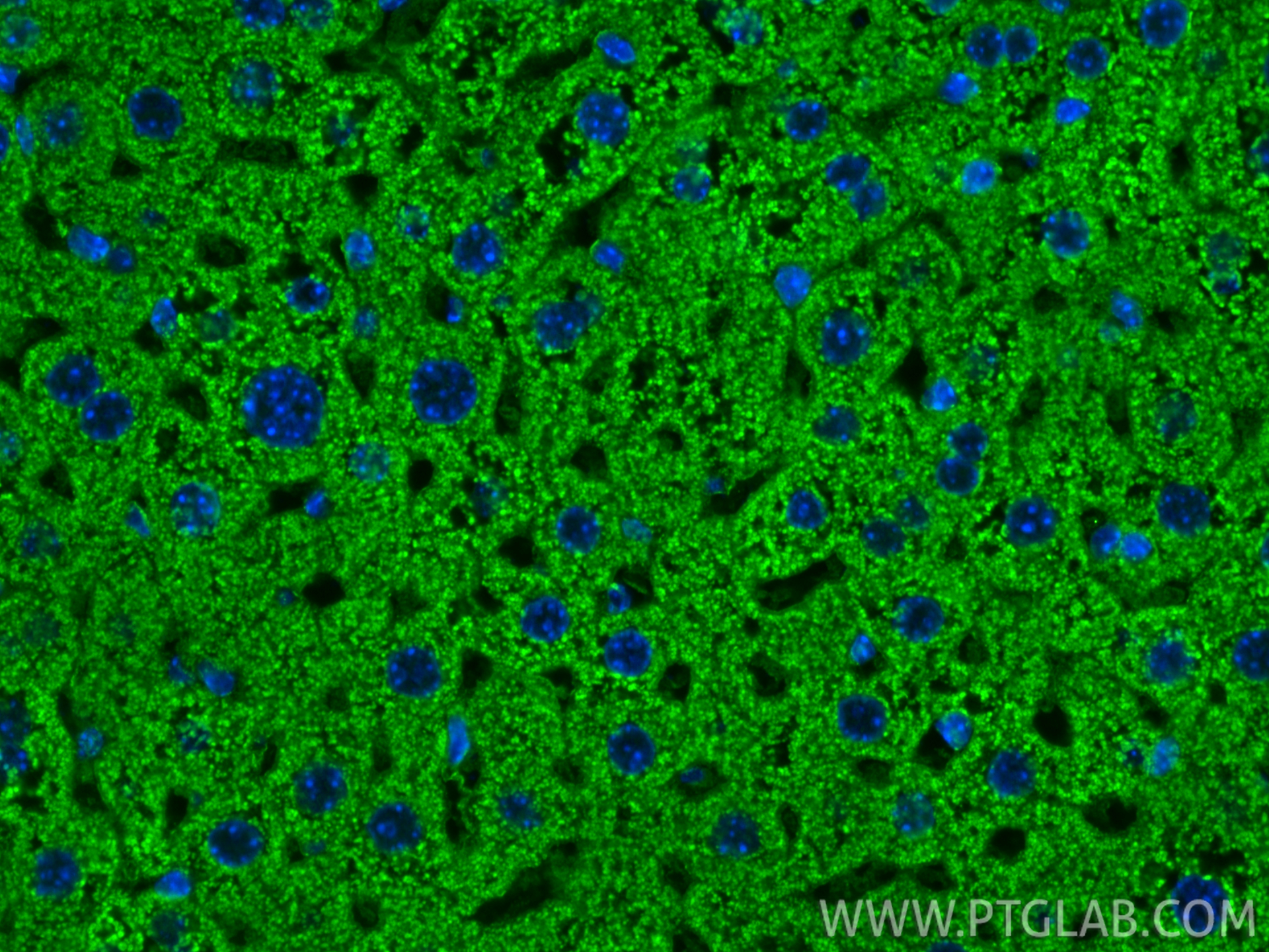 IF Staining of mouse liver using 67702-1-Ig IF Staining of mouse liver using 67702-1-Ig