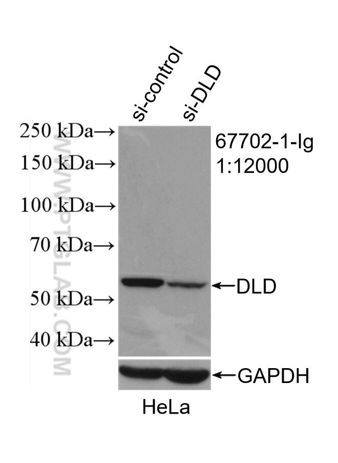 WB analysis of HeLa using 67702-1-Ig