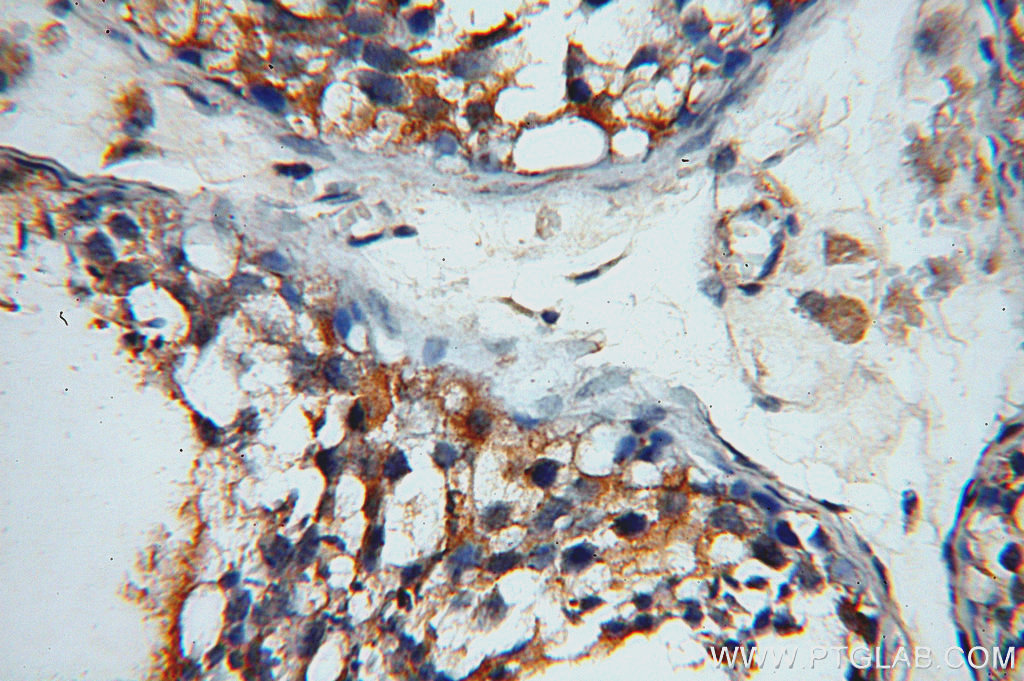 IHC staining of human testis using 20027-1-AP