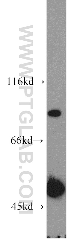 WB analysis of human testis using 20027-1-AP