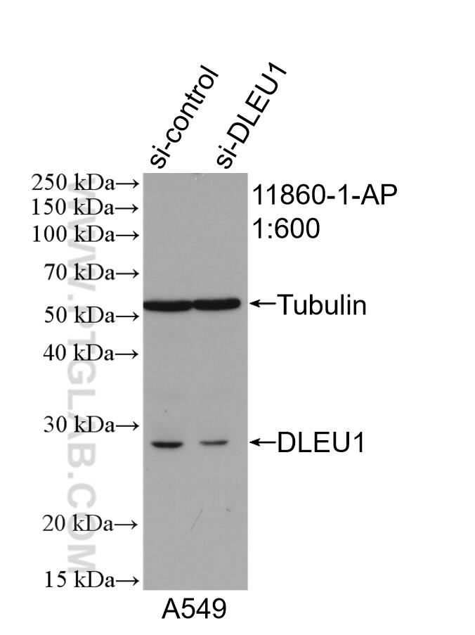 WB analysis of A549 using 11860-1-AP